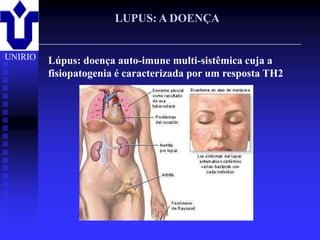 LUPUS: A DOENÇA


UNIRIO    Lúpus: doença auto-imune multi-sistêmica cuja a
          fisiopatogenia é caracterizada por um resposta TH2




         2001/2002            Prof. Doutor José Cabeda    Imunologia
 