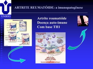 ARTRITE REUMATÓIDE: a imunopatogênese

UNIRIO
                       Artrite reumatóide
                       Doença auto-imune
                       Com base TH1




         2001/2002       Prof. Doutor José Cabeda   Imunologia
 