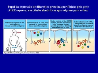 Papel da expressão de diferentes proteínas periféricas pelo gene
AIRE expresso em células dendríticas que migram para o timo
    Figure 13-9




    2001/2002               Prof. Doutor José Cabeda        Imunologia
 
