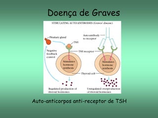 Doença de Graves

Auto-anticorpos anti-receptor de TSH

 