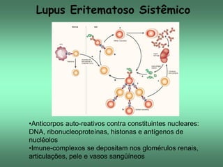 Lupus Eritematoso Sistêmico

•Anticorpos auto-reativos contra constituintes nucleares:
DNA, ribonucleoproteínas, histonas e antígenos de
nucléolos
•Imune-complexos se depositam nos glomérulos renais,
articulações, pele e vasos sangüíneos

 