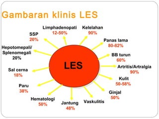 Gambaran klinis LES
LES
SSP
20%
Hepotomepali/
Splenomegali
20%
Sal cerna
18%
Paru
38%
Hematologi
50% Jantung
48%
Vaskulitis
Ginjal
50%
Limphadenopati
12-50%
Kelelahan
90%
Panas lama
80-82%
BB turun
60%
Artritis/Artralgia
90%
Kulit
50-58%
 