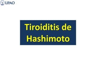 Tiroiditis de
Hashimoto
 