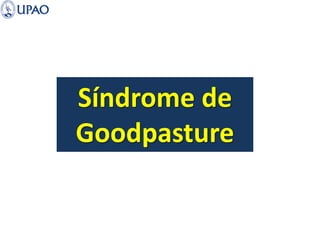 Síndrome de
Goodpasture
 