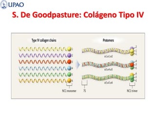 S. De Goodpasture: Colágeno Tipo IV
 