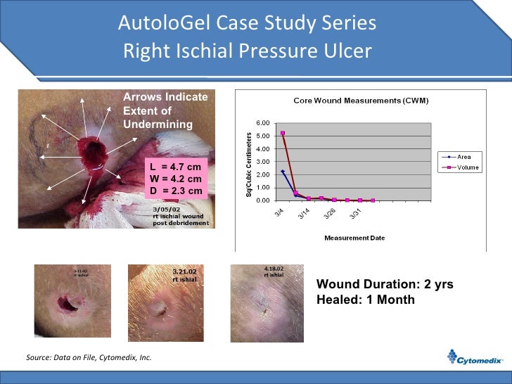 case study dying with a stage iv pressure ulcer case study dying with a stage iv pressure ulcer