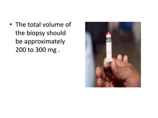 • The total volume of
the biopsy should
be approximately
200 to 300 mg .
 