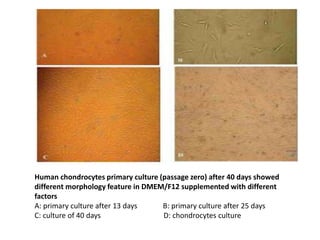 Human chondrocytes primary culture (passage zero) after 40 days showed
different morphology feature in DMEM/F12 supplemented with different
factors
A: primary culture after 13 days B: primary culture after 25 days
C: culture of 40 days D: chondrocytes culture
 