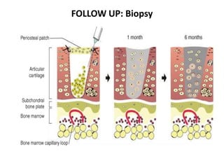 FOLLOW UP: Biopsy
 