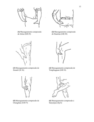 13




     (1) Massageamento-compressão      (2) Massageamento-compressão
     de Juliao (GB 29)                 de Huantiao (GB 30)




(3) Massageamento-compressão de     (4) Massageamento-compressão de
Zusanli (St 36)                     Yanglingquan (GB 34)




(5) Massageamento-compressão de     (6) Massageamento-compressão e
Chengshan (UB 57)                   Sanyinjiao (Sp 6)
 