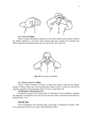 6




        (4) Cavar as Orbitas
        Dobre os dedos indicadores, empregue os seus lados radiais contra as partes internas
das órbitas superiores e cave dos cantos internos para fora, seguido de cavamento das
árbitas inferiores da mesma maneira, por cerca de 20-30 vezes (Fig. 4-9).




                              Fig. 4-9 Cavamento das Órbitas


       (5) “Passar a ferro” os Olhos
       Feche os olhos levemente. Friccione as mãos uma contra a outra até que fiquem
quentes e cubra os olhos com a raiz da palma para “passar a ferro” os olhos por cerca de 30
segundos seguidos de friccionamento deles 10 vezes ou mais (Fig.-10).
       (6) Massagear Taiyang (Extra 2)
       Comprima os pontos de Taiyang (Extra 2) fortemente com as superfícies estriadas
dos polegares e massageie-os por cerca de 30 vezes para obter a sensação de desconforto e
distensão (Fig. 4-11).

       FUNÇÃO
        Estas manipulações são eficientes para a prevenção e tratamento da miopia, visão
turva, glaucoma, atrofia ótica e outras enfermidades dos olhos.
 