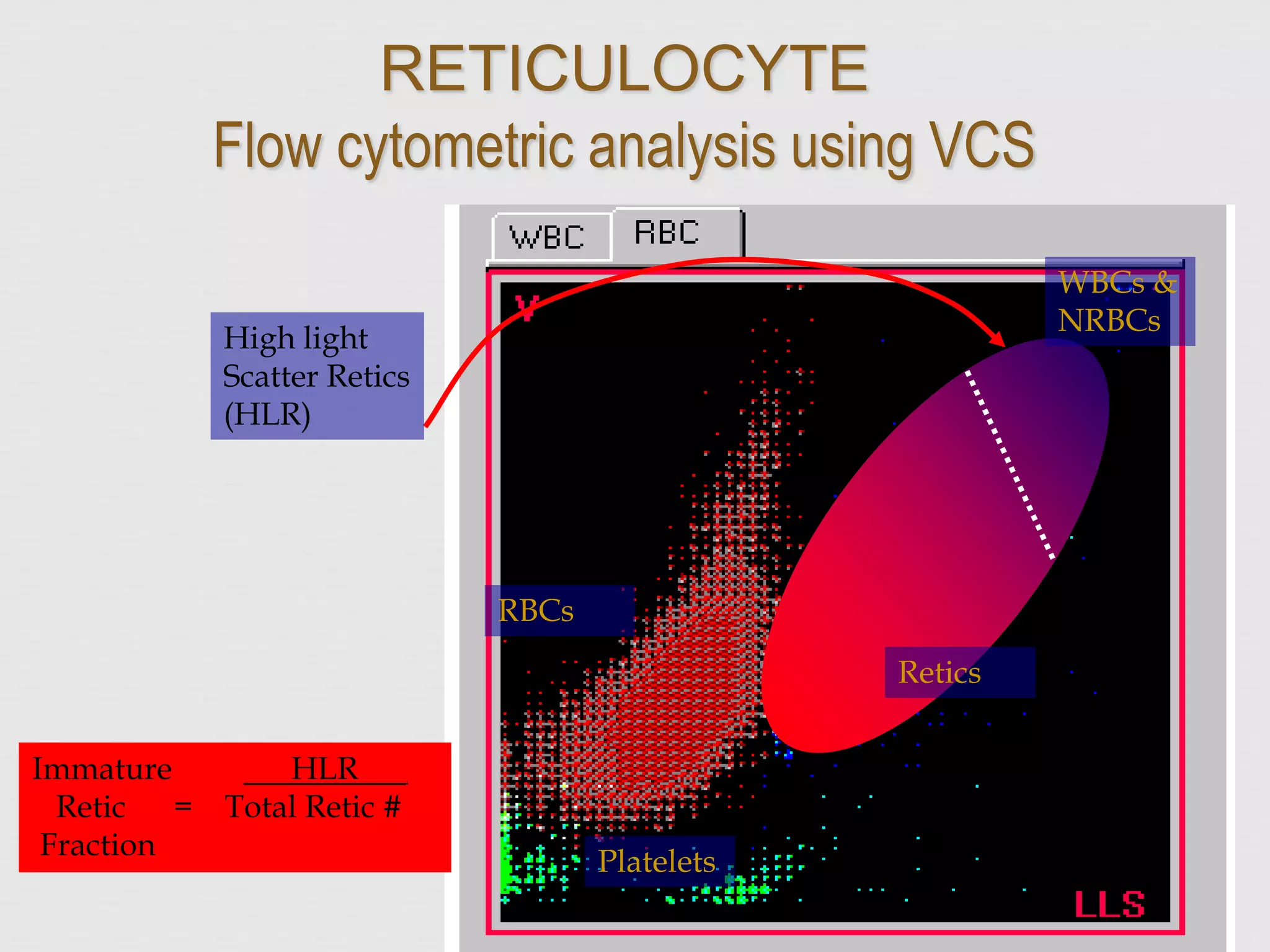 Immature HLR .
Retic = Total Retic #
Fraction
High light
Scatter Retics
(HLR)
RBCs
Platelets
WBCs &
NRBCs
Retics
RETICULOCYTE
Flow cytometric analysis using VCS
 