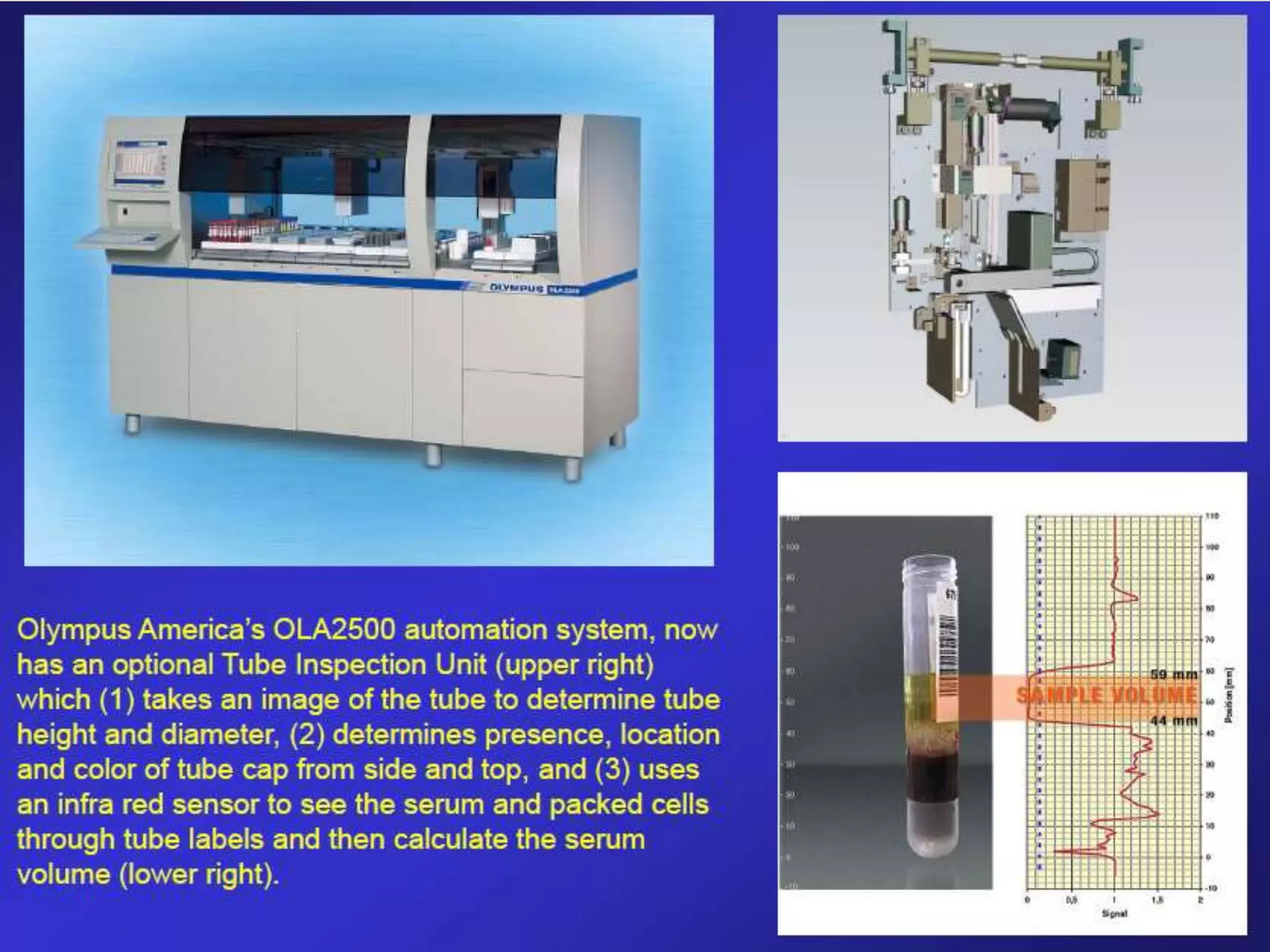 
 5million sample analysis /year
 100 parameters in patient samples, including blood, urine
and CSF
 They are linked to Novel laboratory information system
MOLIS (Sysmex)
OLYMPUS OLA2500
 