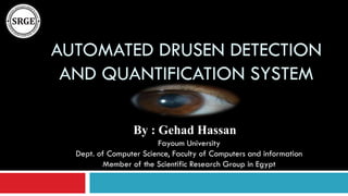 AUTOMATED DRUSEN DETECTION
AND QUANTIFICATION SYSTEM
By : Gehad Hassan
Fayoum University
Dept. of Computer Science, Faculty of Computers and information
Member of the Scientific Research Group in Egypt

 