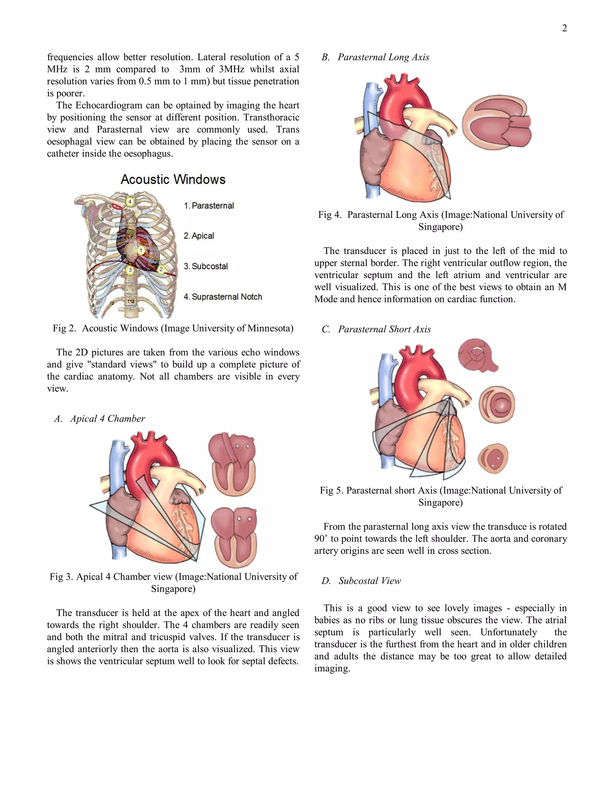 2

frequencies allow better resolution. Lateral resolution of a 5      B. Parasternal Long Axis
MHz is 2 mm compared to 3mm of 3MHz whilst axial
resolution varies from 0.5 mm to 1 mm) but tissue penetration
is poorer.
   The Echocardiogram can be optained by imaging the heart
by positioning the sensor at different position. Transthoracic
view and Parasternal view are commonly used. Trans
oesophagal view can be obtained by placing the sensor on a
catheter inside the oesophagus.




                                                                   Fig 4. Parasternal Long Axis (Image:National University of
                                                                                           Singapore)

                                                                     The transducer is placed in just to the left of the mid to
                                                                   upper sternal border. The right ventricular outflow region, the
                                                                   ventricular septum and the left atrium and ventricular are
                                                                   well visualized. This is one of the best views to obtain an M
                                                                   Mode and hence information on cardiac function.

 Fig 2. Acoustic Windows (Image University of Minnesota)            C. Parasternal Short Axis

  The 2D pictures are taken from the various echo windows
and give "standard views" to build up a complete picture of
the cardiac anatomy. Not all chambers are visible in every
view.

 A. Apical 4 Chamber




                                                                    Fig 5. Parasternal short Axis (Image:National University of
                                                                                             Singapore)

                                                                     From the parasternal long axis view the transduce is rotated
                                                                   90˚ to point towards the left shoulder. The aorta and coronary
                                                                   artery origins are seen well in cross section.

Fig 3. Apical 4 Chamber view (Image:National University of          D. Subcostal View
                       Singapore)

   The transducer is held at the apex of the heart and angled         This is a good view to see lovely images - especially in
towards the right shoulder. The 4 chambers are readily seen        babies as no ribs or lung tissue obscures the view. The atrial
and both the mitral and tricuspid valves. If the transducer is     septum is particularly well seen. Unfortunately             the
angled anteriorly then the aorta is also visualized. This view     transducer is the furthest from the heart and in older children
is shows the ventricular septum well to look for septal defects.   and adults the distance may be too great to allow detailed
                                                                   imaging.
 