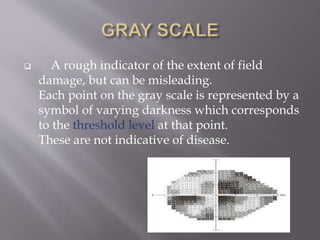  A rough indicator of the extent of field
damage, but can be misleading.
Each point on the gray scale is represented by a
symbol of varying darkness which corresponds
to the threshold level at that point.
These are not indicative of disease.
 