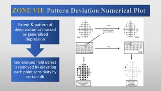 Generalised field defect
is removed by elevating
each point sensitivity by
certain db
Extent & pattern of
deep scotomas masked
by generalised
depression
 