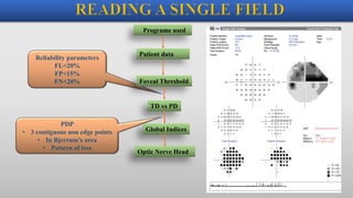 Reliability parameters
FL<20%
FP<15%
FN<20%
Programe used
Patient data
Foveal Threshold
TD vs PD
Global Indices
Optic Nerve Head
PDP
• 3 contiguous non edge points
• In Bjerrum’s area
• Pattern of loss
 