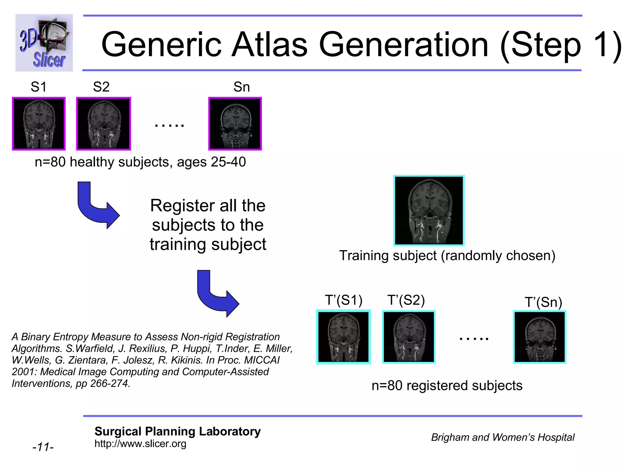 Generic Atlas Generation (Step 1) Register all the subjects to the training subject … .. S1 S2 Sn n=80 healthy subjects, ages 25-40 Training subject (randomly chosen) … .. T’(S1) T’(S2) T’(Sn) n=80 registered subjects A Binary Entropy Measure to Assess Non-rigid Registration Algorithms. S.Warfield, J. Rexilius, P. Huppi, T.Inder, E. Miller, W.Wells, G. Zientara, F. Jolesz, R. Kikinis. In Proc. MICCAI 2001: Medical Image Computing and Computer-Assisted Interventions, pp 266-274.  