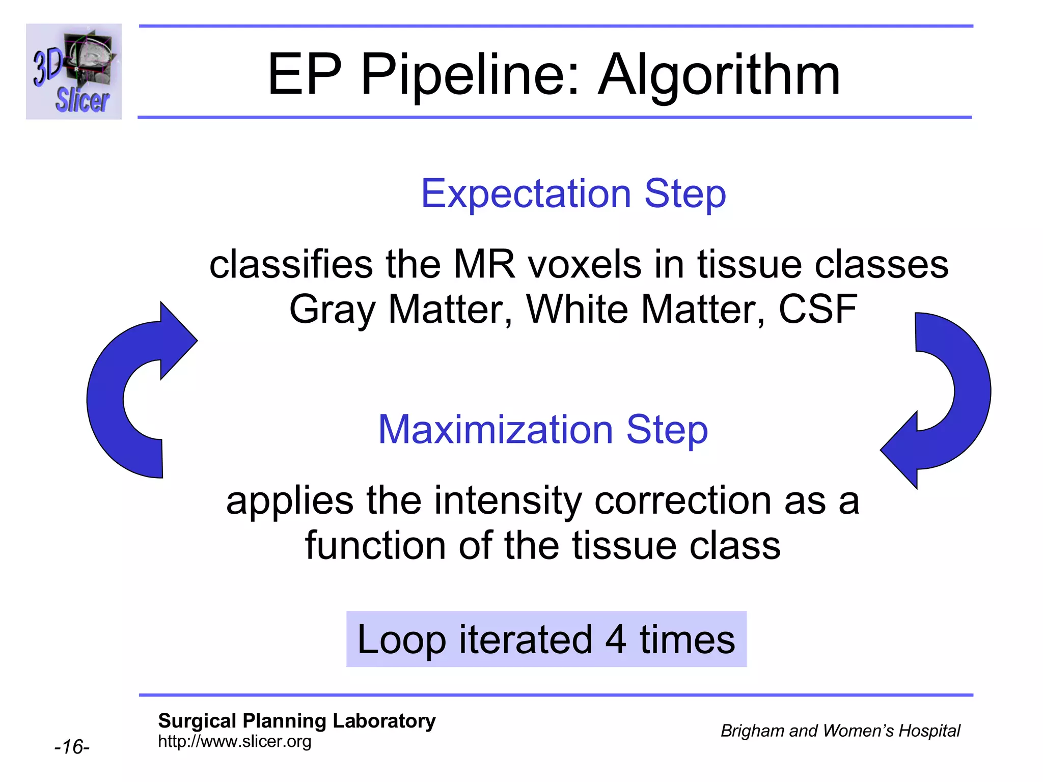 EP Pipeline: Algorithm   Maximization Step applies the intensity correction as a function of the tissue class Expectation Step classifies the MR voxels in tissue classes Gray Matter, White Matter, CSF Loop iterated 4 times 