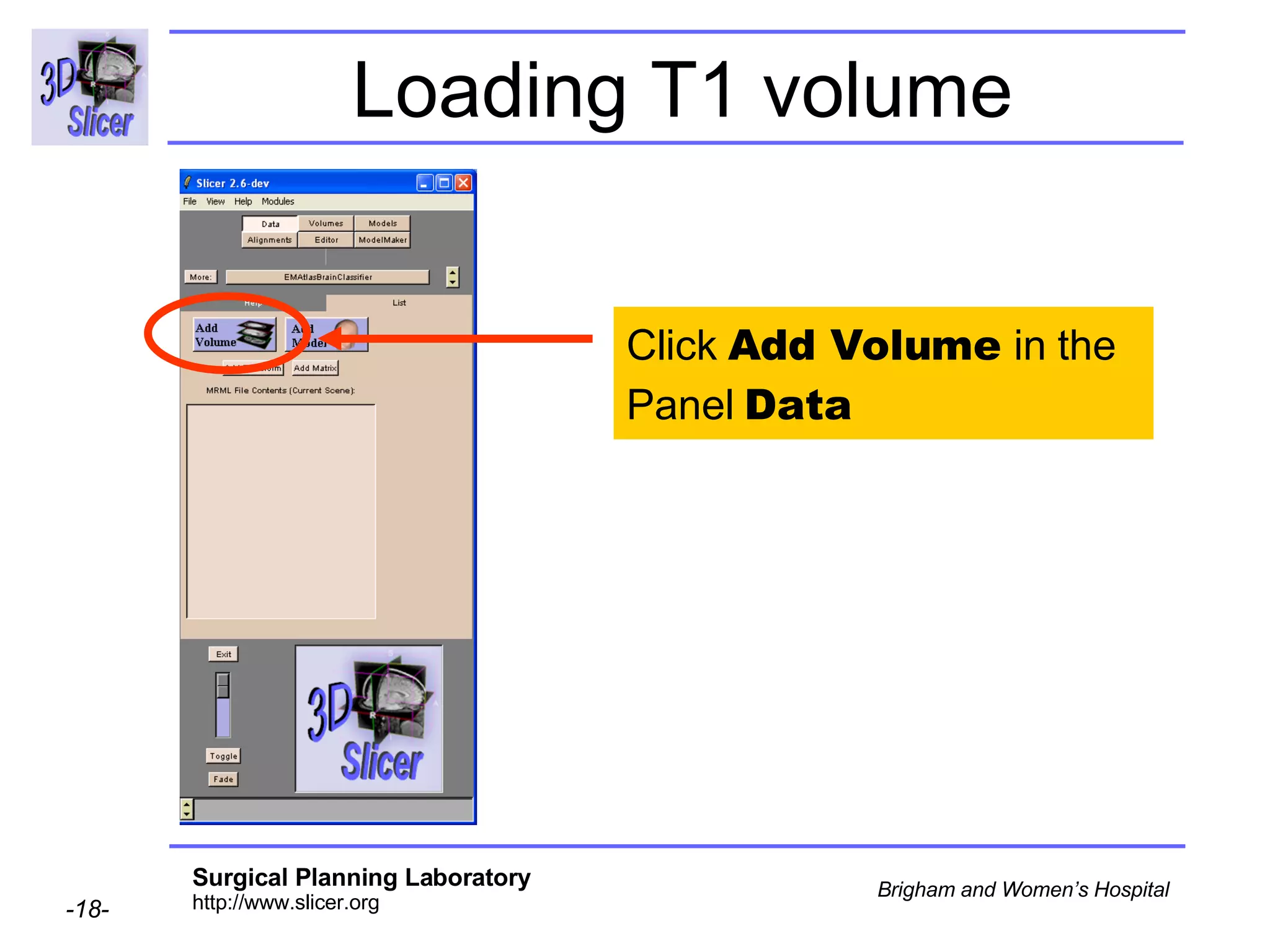 Loading T1 volume Click  Add Volume  in the Panel  Data 