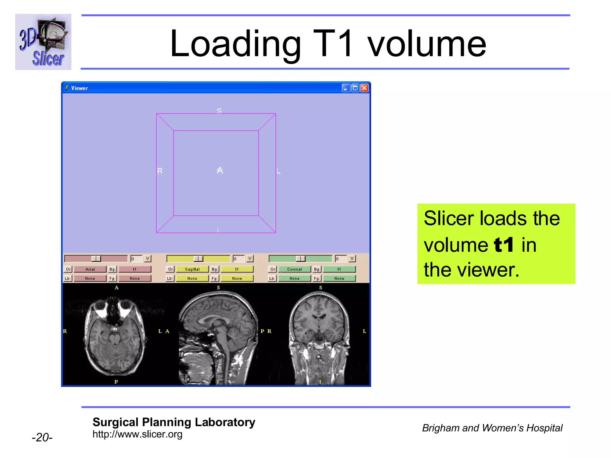 Loading T1 volume Slicer loads the volume  t1  in the viewer. 