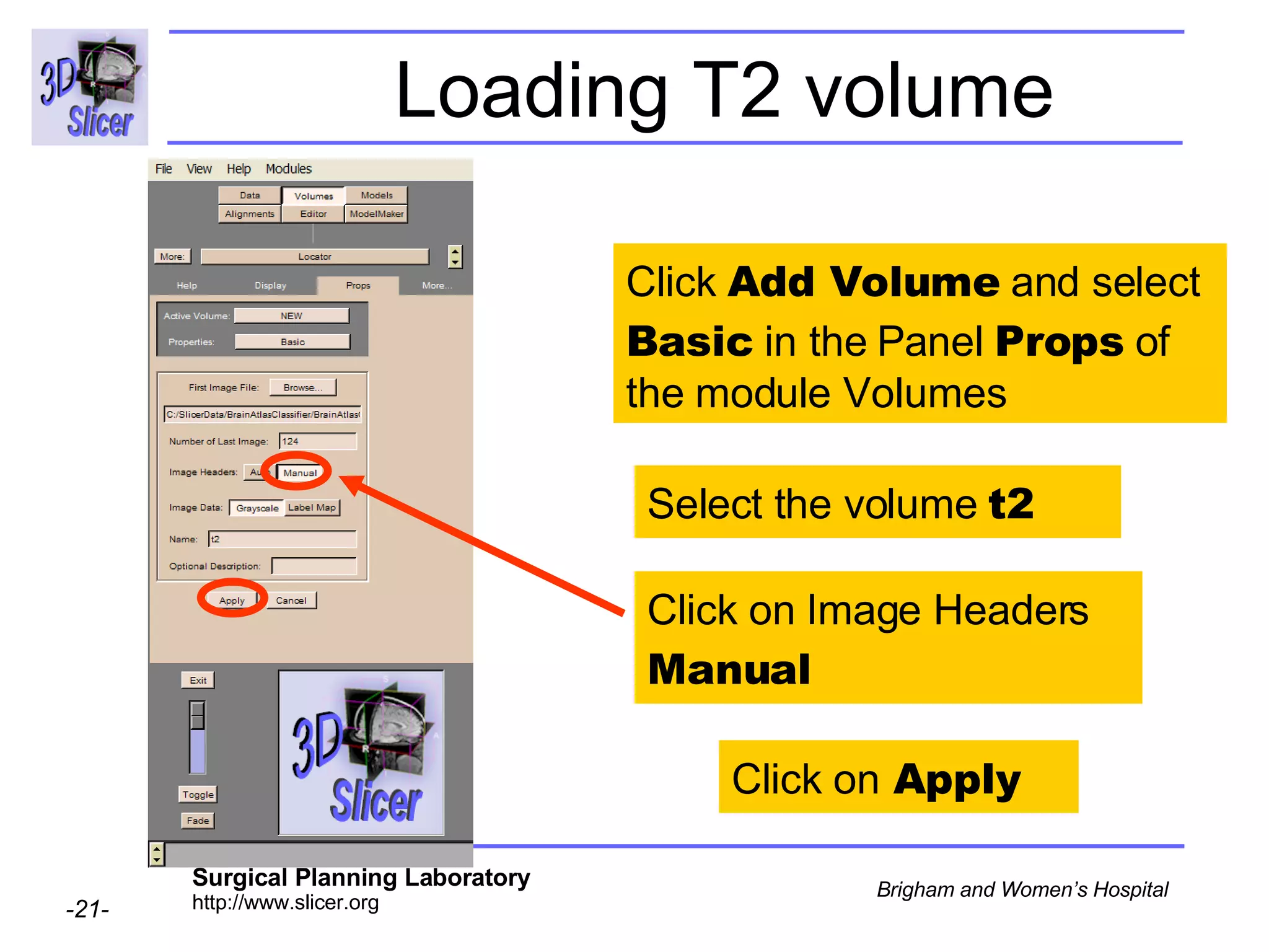 Loading T2 volume Click on Image Headers  Manual Click  Add Volume  and select  Basic  in the Panel  Props  of the module Volumes Select the volume  t2 Click on  Apply 