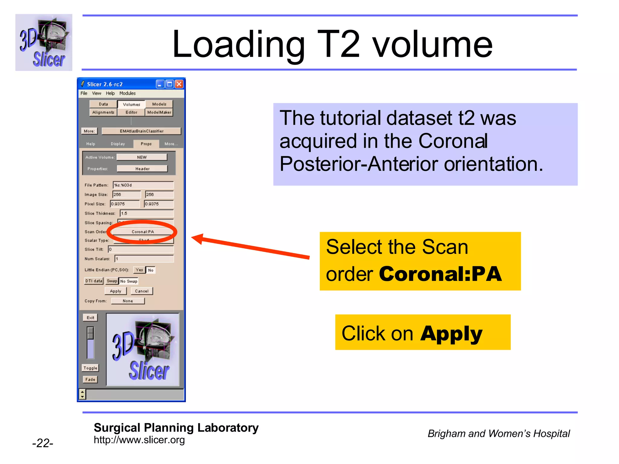 Loading T2 volume The tutorial dataset t2 was acquired in the Coronal Posterior-Anterior orientation. Select the Scan order  Coronal:PA Click on  Apply 