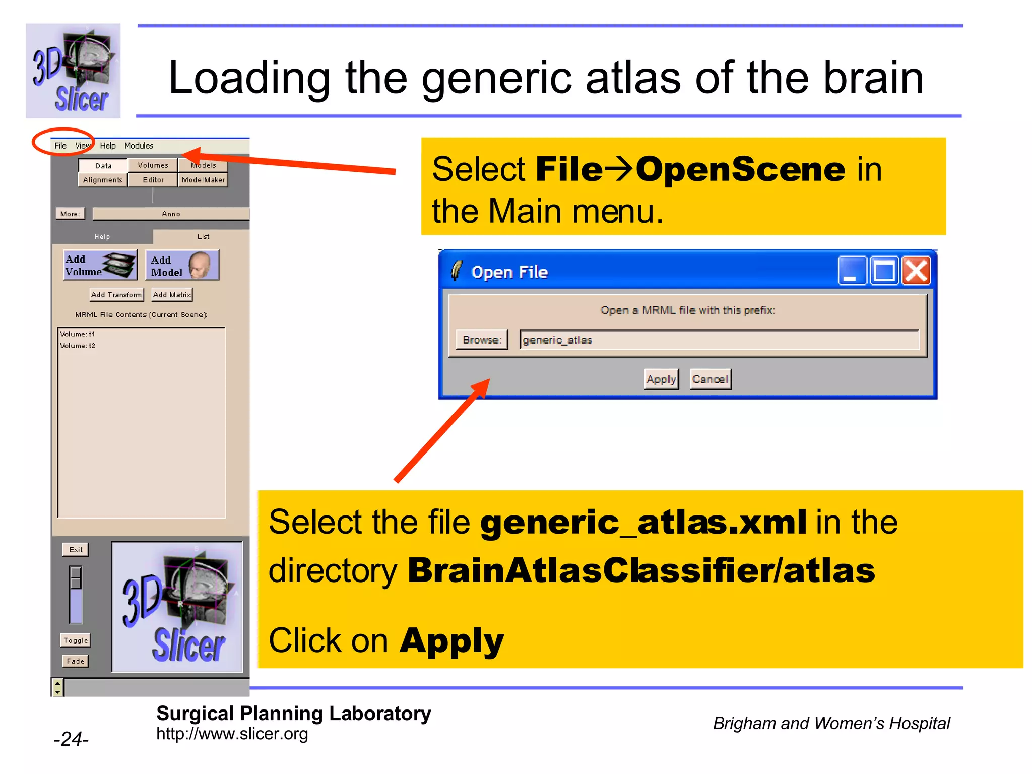 Loading the generic atlas of the brain   Select  File  OpenScene  in the Main menu. Select the file  generic_atlas.xml  in the directory  BrainAtlasClassifier/atlas Click on  Apply 
