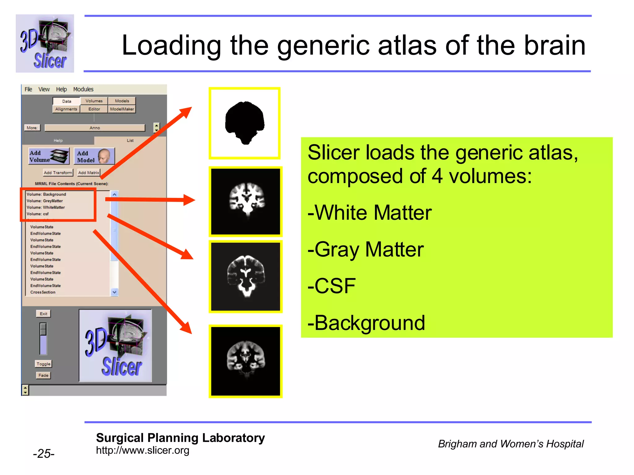 Loading the generic atlas of the brain Slicer loads the generic atlas, composed of 4 volumes:  White Matter  Gray Matter  CSF Background 