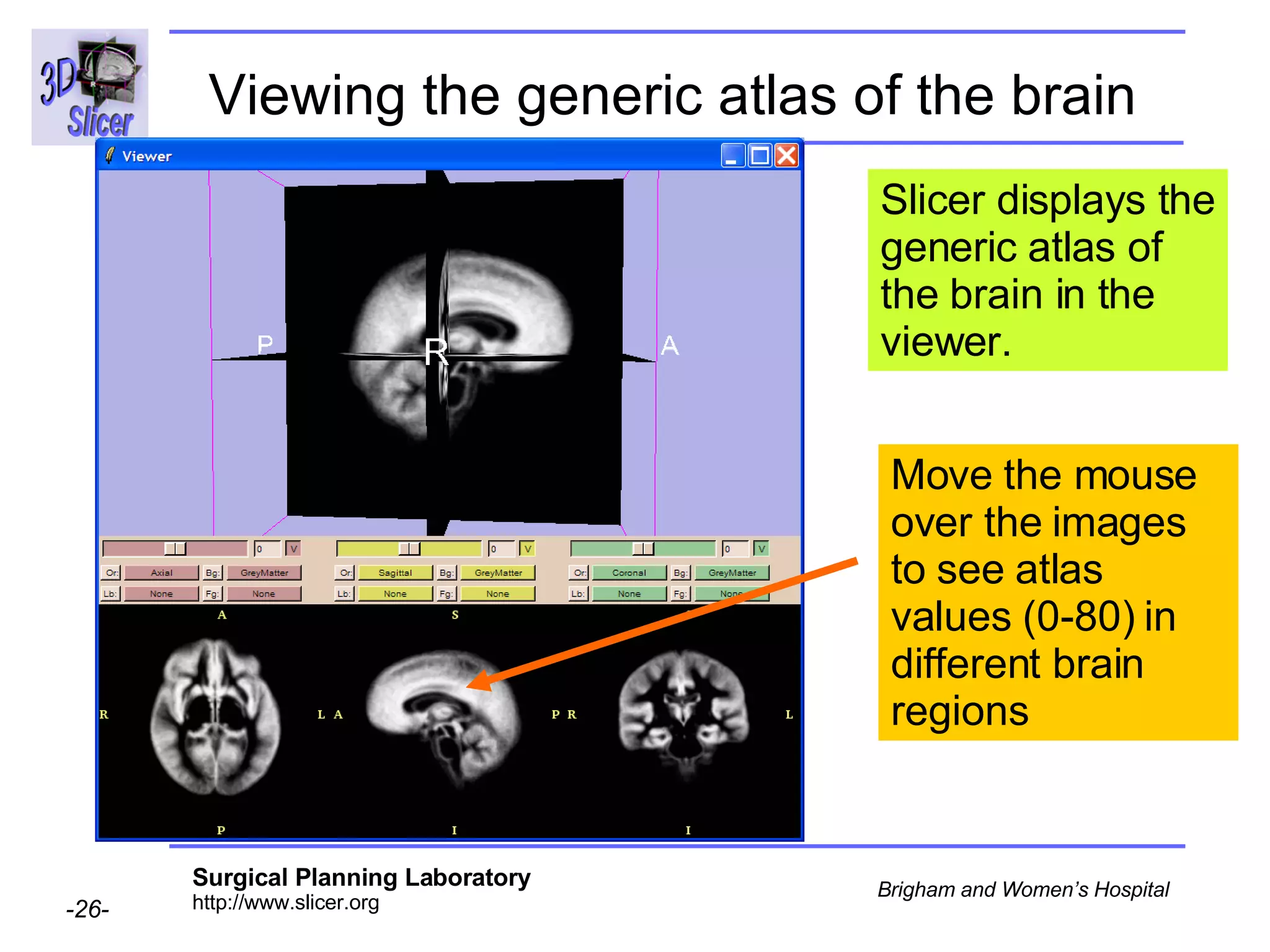 Viewing the generic atlas of the brain   Move the mouse over the images to see atlas values (0-80) in different brain regions Slicer displays the generic atlas of the brain in the viewer. 