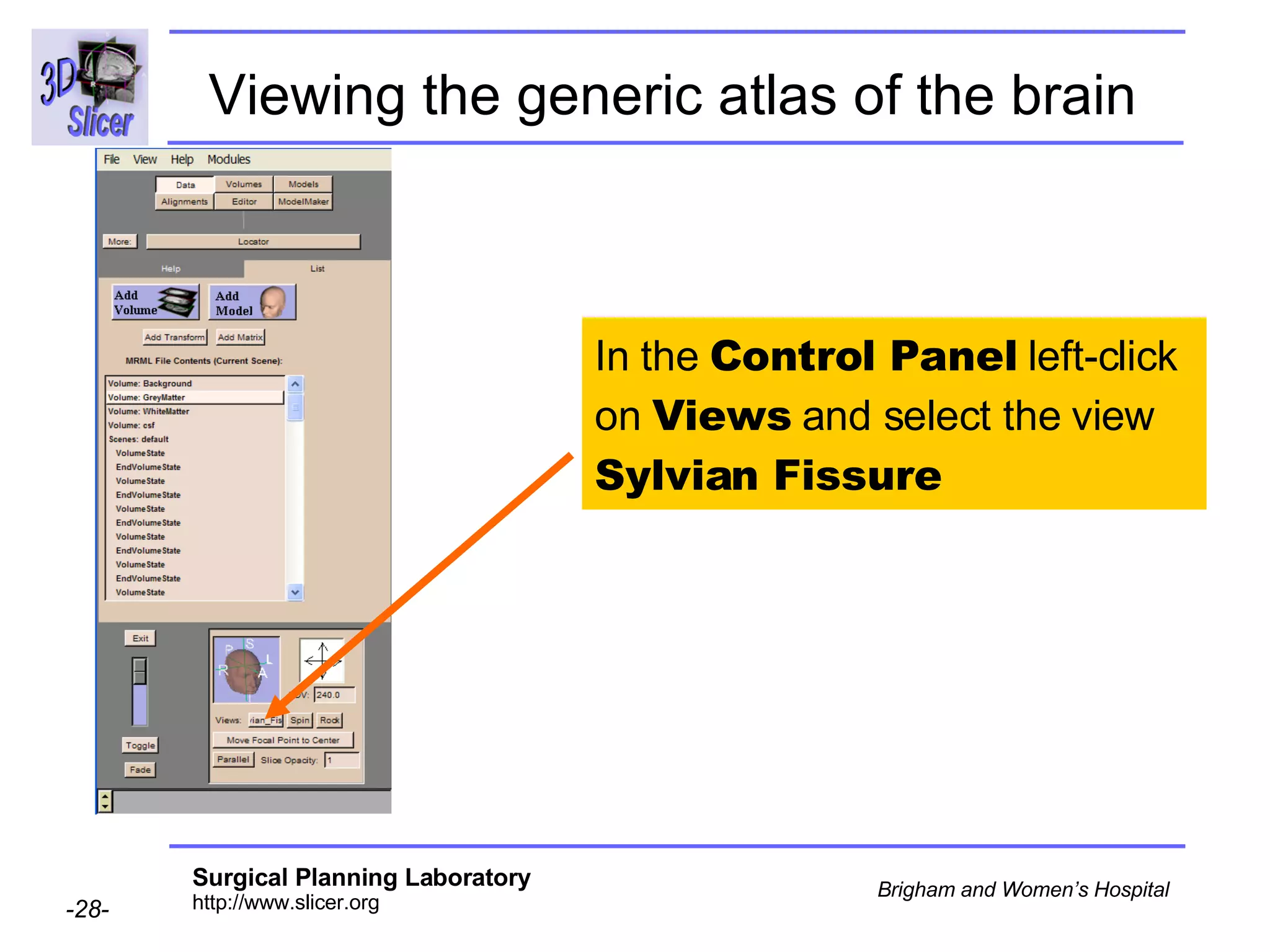 Viewing the generic atlas of the brain   In the  Control Panel  left-click on  Views  and select the view  Sylvian Fissure 