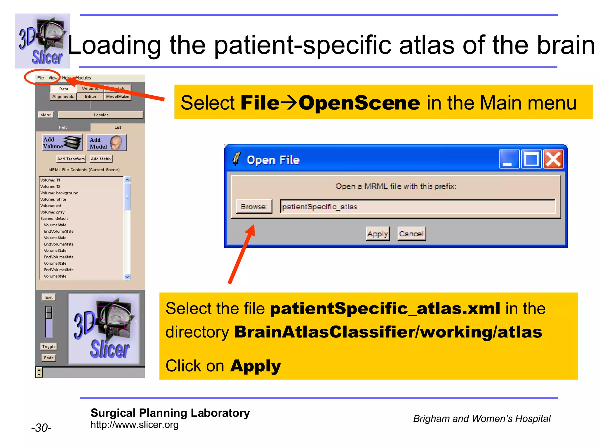 Loading the patient-specific atlas of the brain   Select  File  OpenScene  in the Main menu Select the file  patientSpecific_atlas.xml  in the directory  BrainAtlasClassifier/working/atlas Click on  Apply 