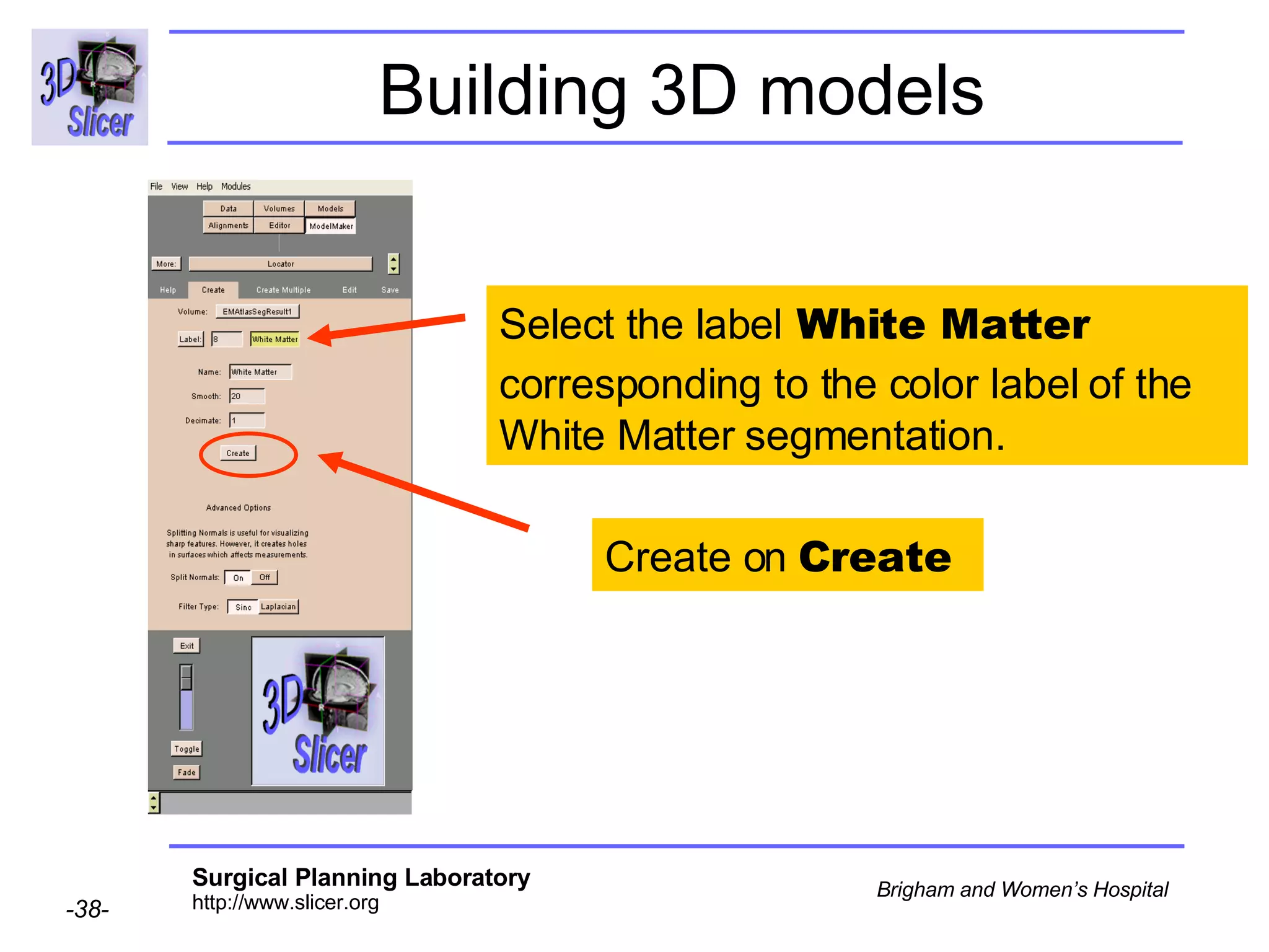 Building 3D models Select the label  White Matter  corresponding to the color label of the   White Matter segmentation. Create on  Create  