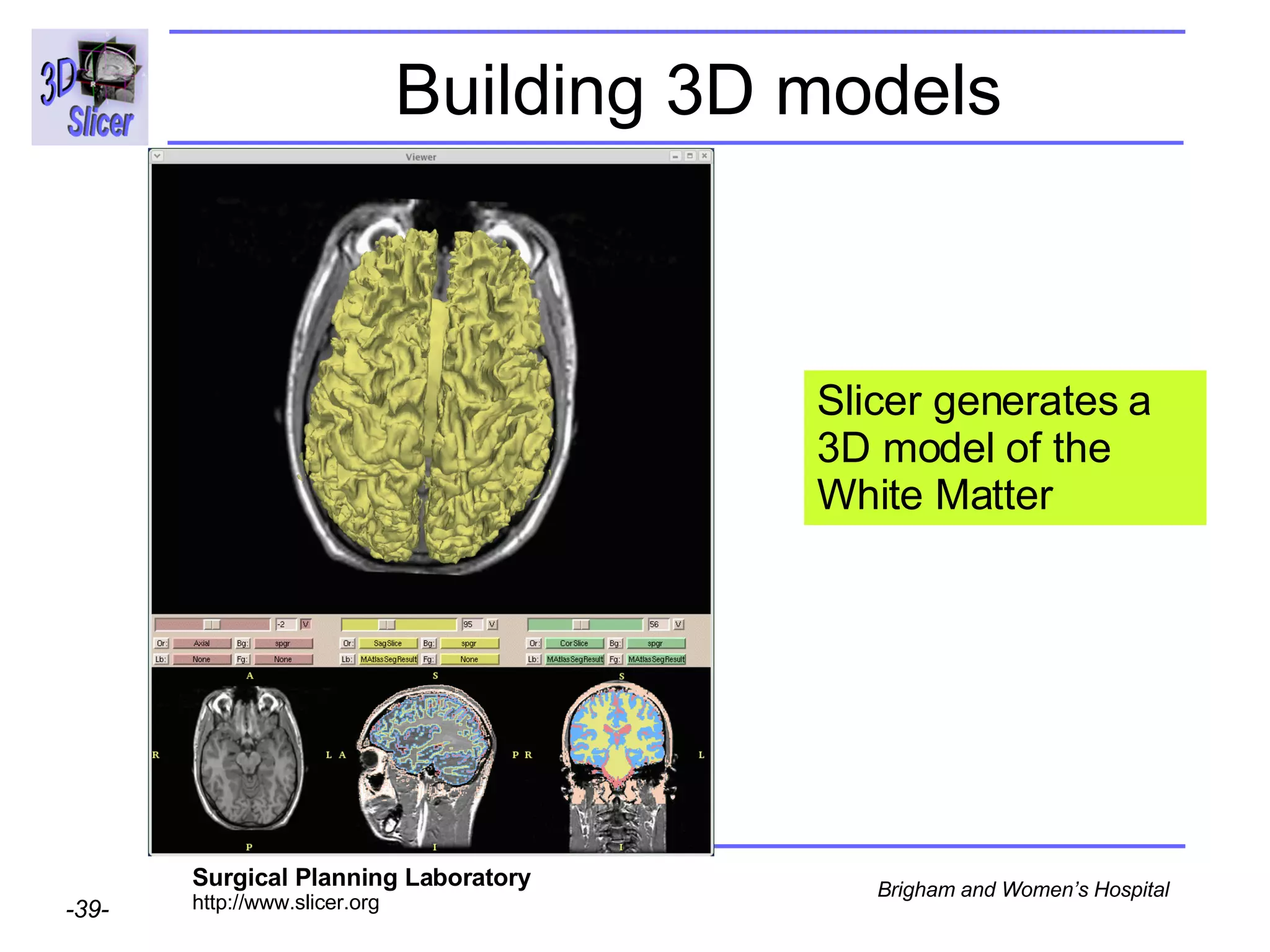 Building 3D models Slicer generates a 3D model of the White Matter 