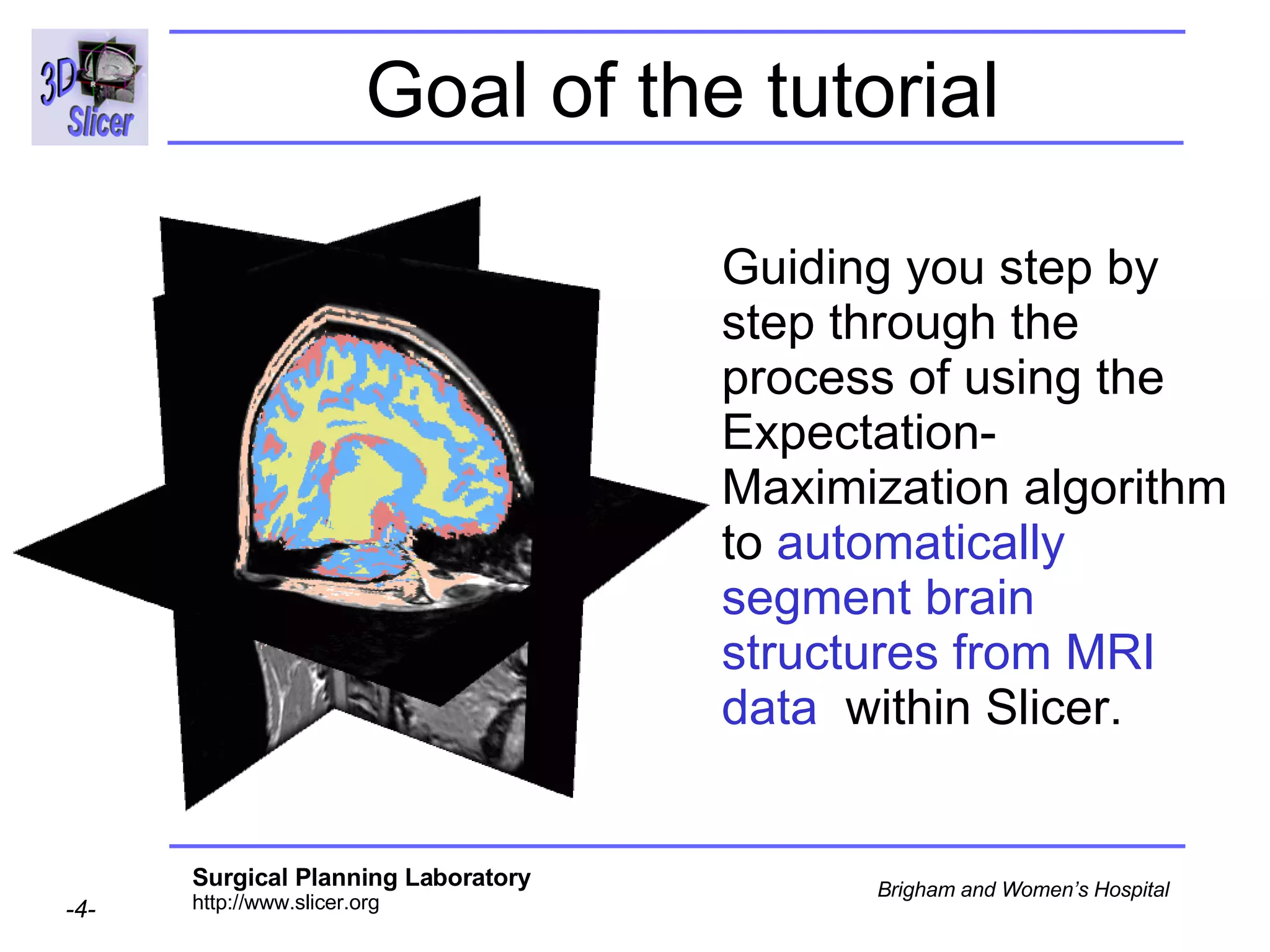 Goal of the tutorial Guiding you step by step through the process of using the Expectation-Maximization algorithm to  automatically segment brain structures from MRI data   within Slicer. 