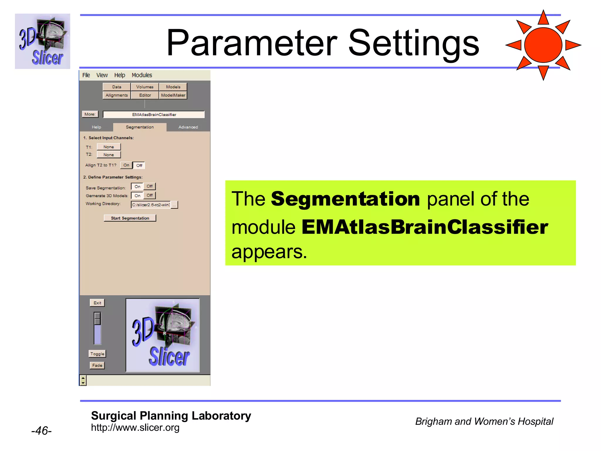 Parameter Settings The  Segmentation  panel of the module  EMAtlasBrainClassifier  appears. 