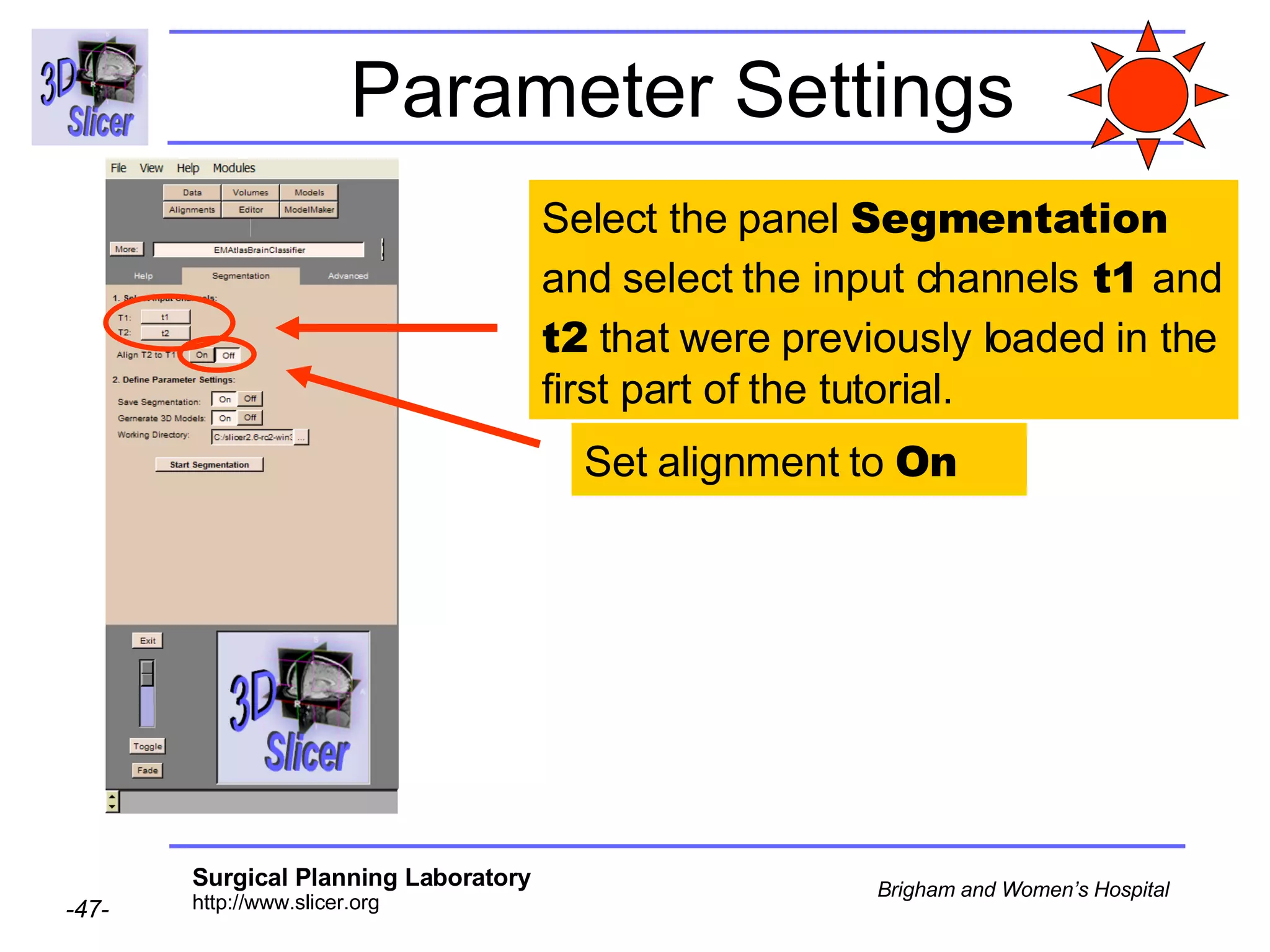 Parameter Settings Select the panel  Segmentation  and select the input channels  t1  and  t2  that were previously loaded in the first part of the tutorial. Set alignment to  On  
