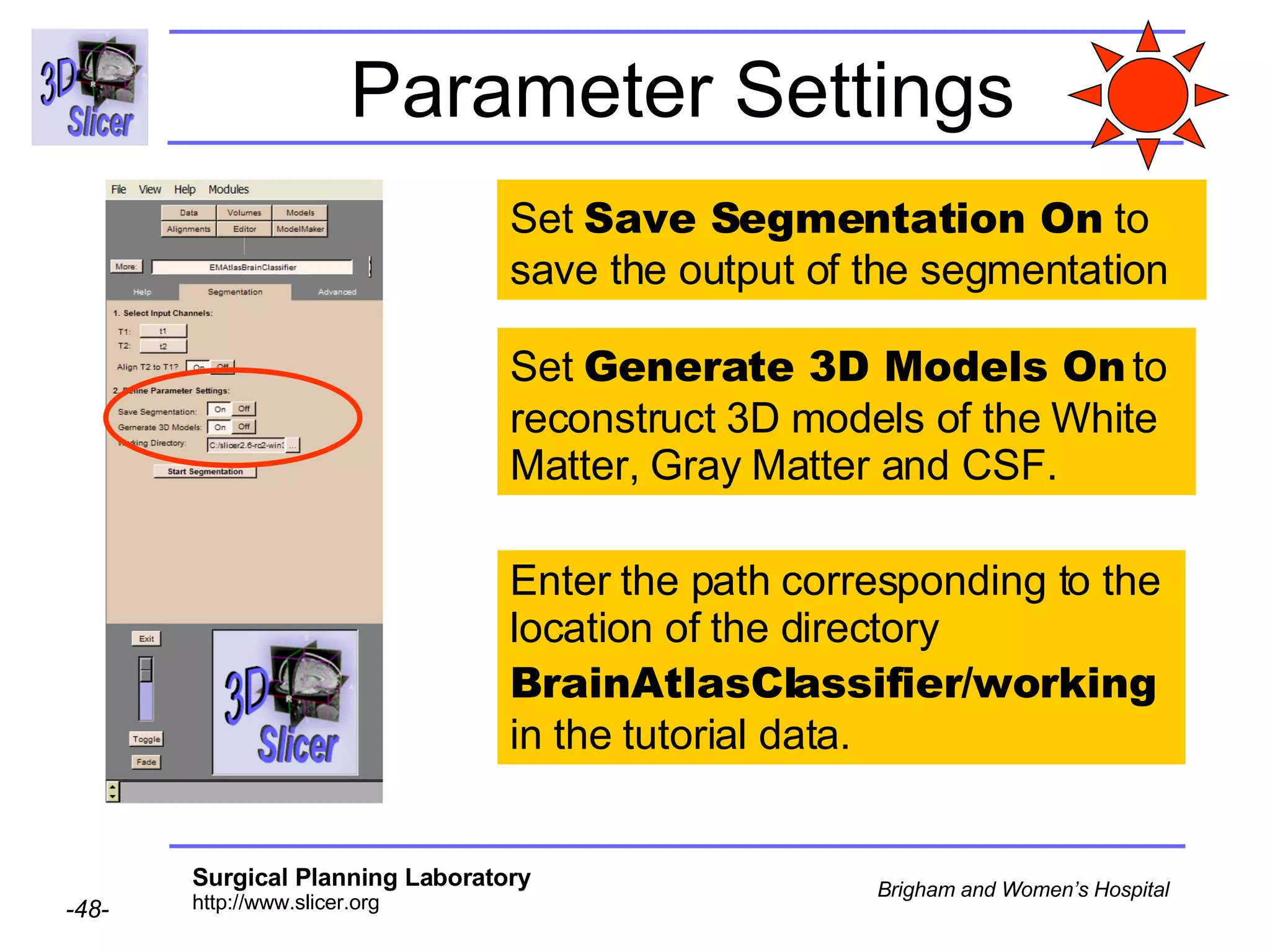 Parameter Settings Set  Save Segmentation On  to save the output of the segmentation Enter the path corresponding to the location of the directory  BrainAtlasClassifier/working  in the tutorial data. Set  Generate 3D Models On  to reconstruct 3D models of the White Matter, Gray Matter and CSF. 
