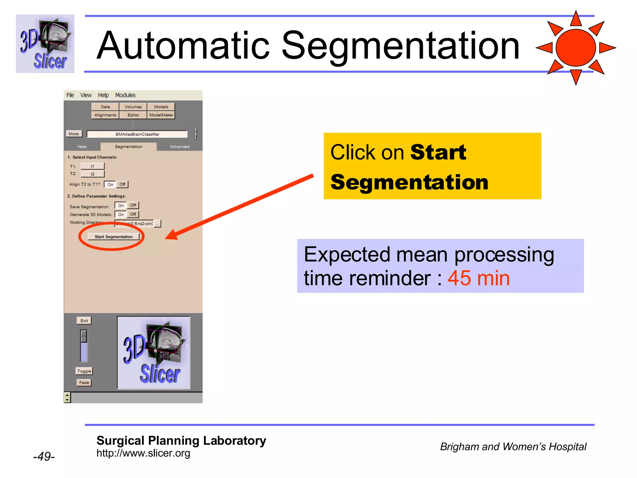Automatic Segmentation Click on  Start   Segmentation Expected mean processing time reminder :  45 min 