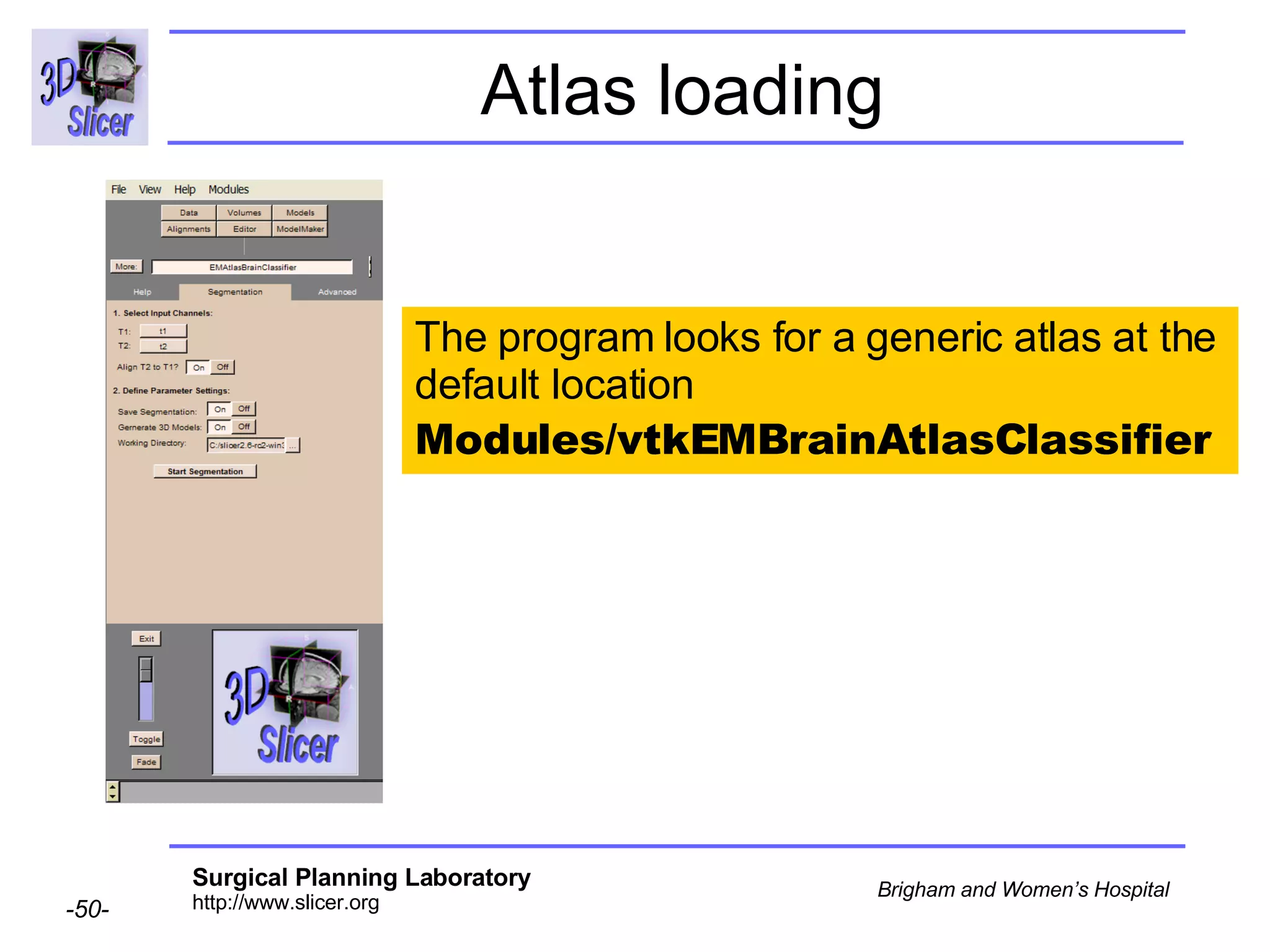 Atlas loading The program looks for a generic atlas at the default location  Modules/vtkEMBrainAtlasClassifier 