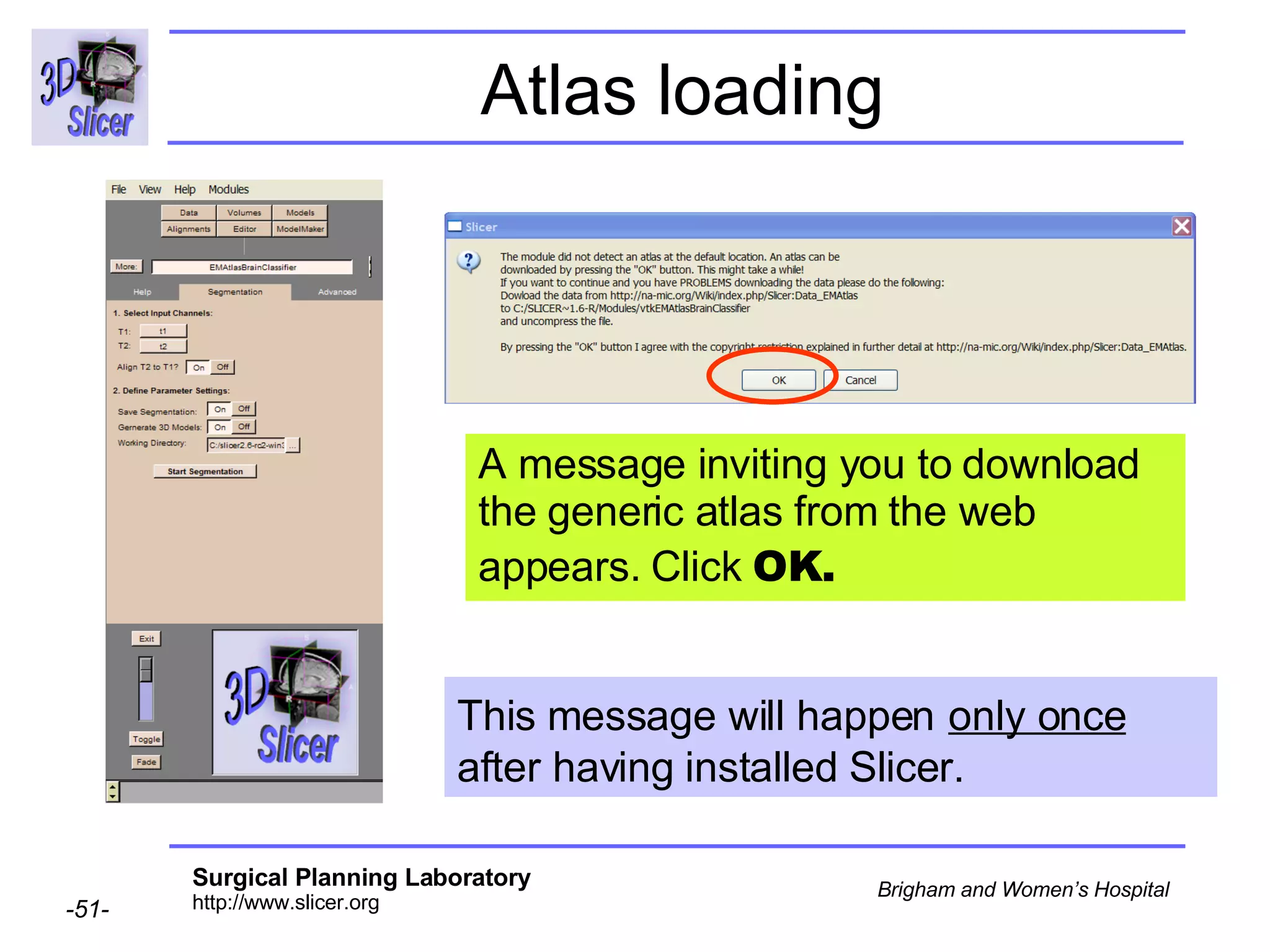 Atlas loading A message inviting you to download the generic atlas from the web appears. Click  OK.  This message will happen   only once   after having installed Slicer. 