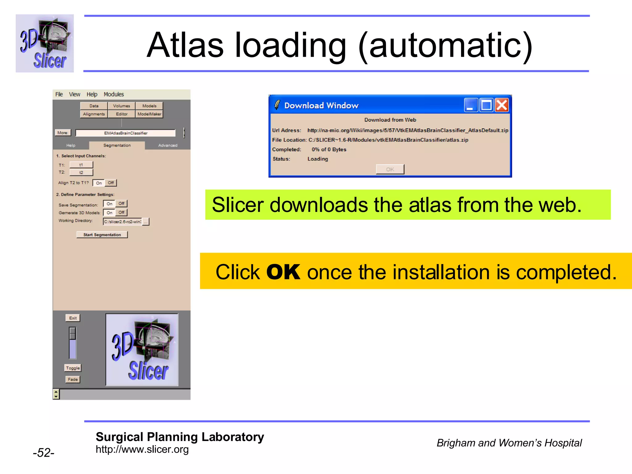Atlas loading (automatic) Slicer downloads the atlas from the web. Click  OK  once the installation is completed. 