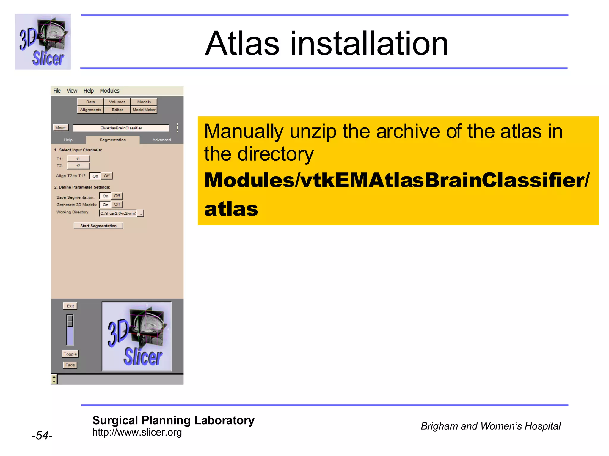 Atlas installation Manually unzip the archive of the atlas in the directory  Modules/vtkEMAtlasBrainClassifier/atlas  