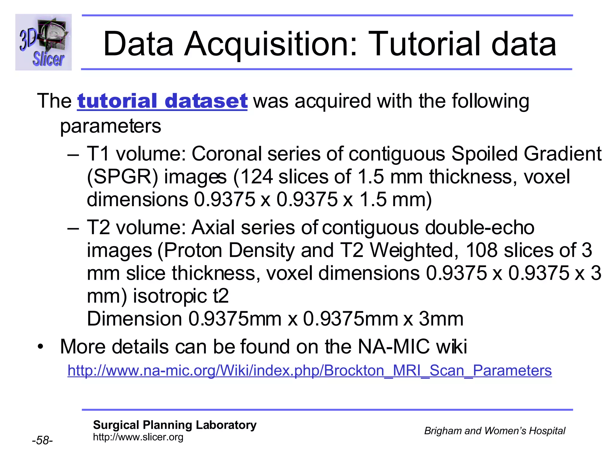 Data Acquisition: Tutorial data The  tutorial dataset  was acquired with the following parameters T1 volume: Coronal series of contiguous Spoiled Gradient (SPGR) images (124 slices of 1.5 mm thickness, voxel dimensions 0.9375 x 0.9375 x 1.5 mm)  T2 volume: Axial series of contiguous double-echo images (Proton Density and T2 Weighted, 108 slices of 3 mm slice thickness, voxel dimensions 0.9375 x 0.9375 x 3 mm) isotropic t2  Dimension 0.9375mm x 0.9375mm x 3mm  More details can be found on the NA-MIC wiki http://www.na-mic.org/Wiki/index.php/Brockton_MRI_Scan_Parameters 