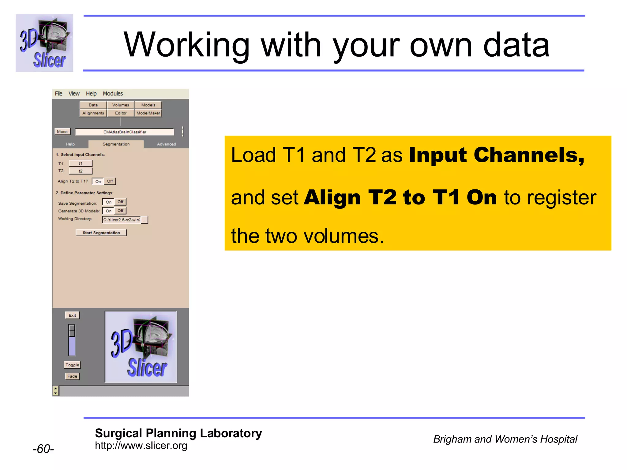 Working with your own data Load T1 and T2 as  Input Channels, and set  Align T2 to T1   On  to register  the two volumes. 