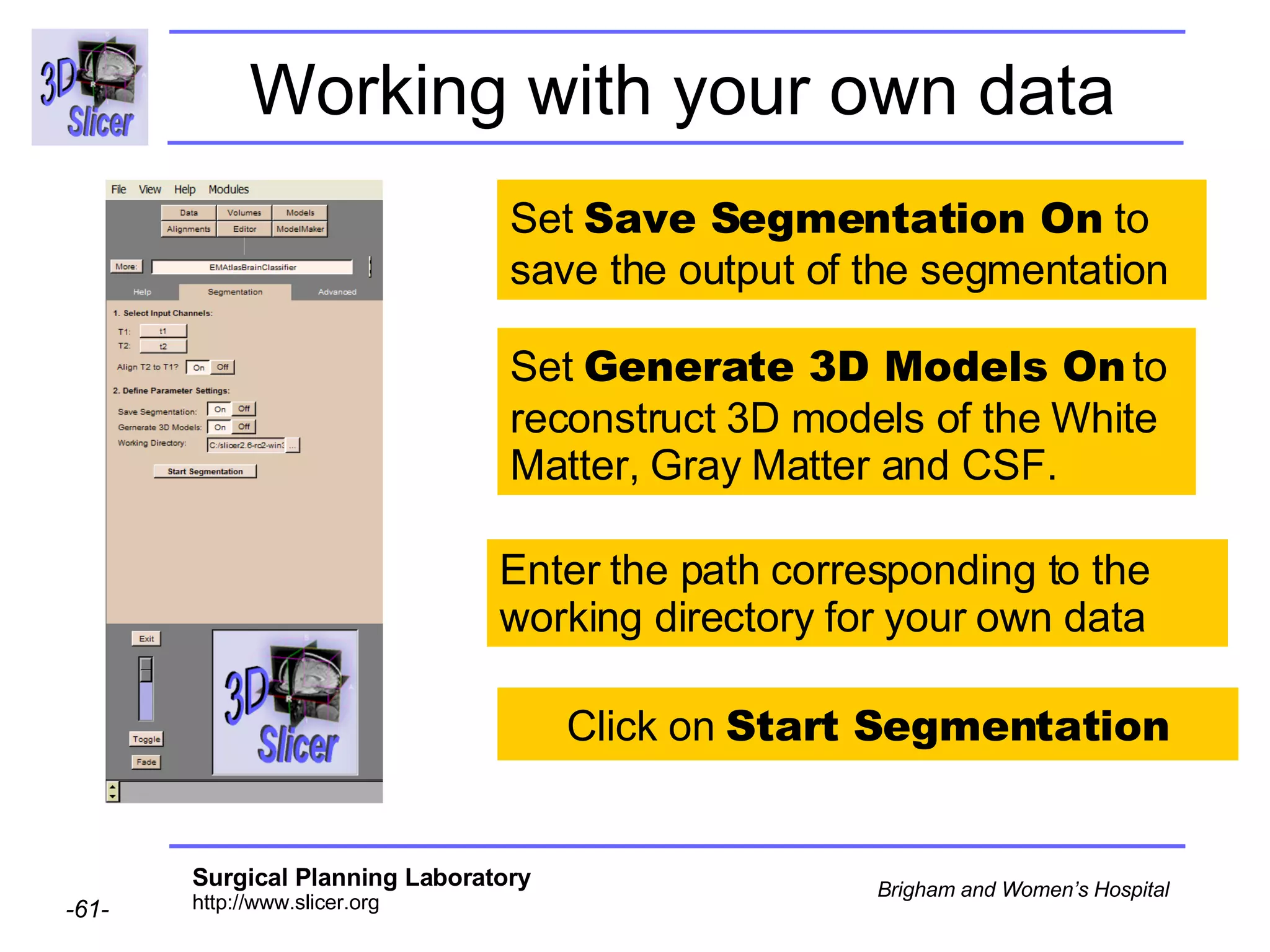 Working with your own data Set  Save Segmentation On  to save the output of the segmentation Enter the path corresponding to the working directory for your own data Set  Generate 3D Models On  to reconstruct 3D models of the White Matter, Gray Matter and CSF. Click on  Start Segmentation 