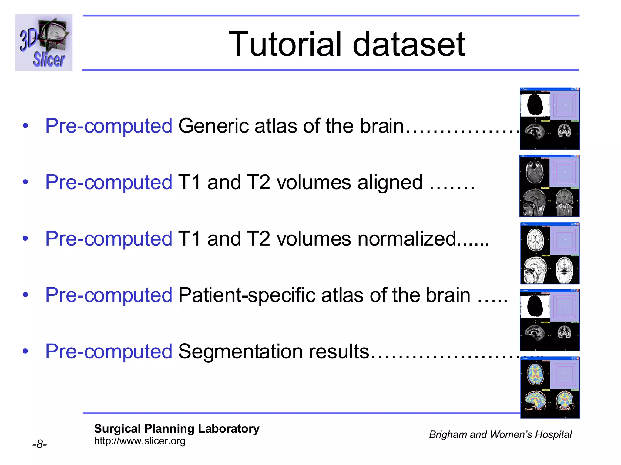 Pre-computed  Generic atlas of the brain…………………. Pre-computed  T1 and T2 volumes aligned ……. Pre-computed  T1 and T2 volumes normalized...... Pre-computed  Patient-specific atlas of the brain …..  Pre-computed  Segmentation results…………………….. Tutorial dataset 