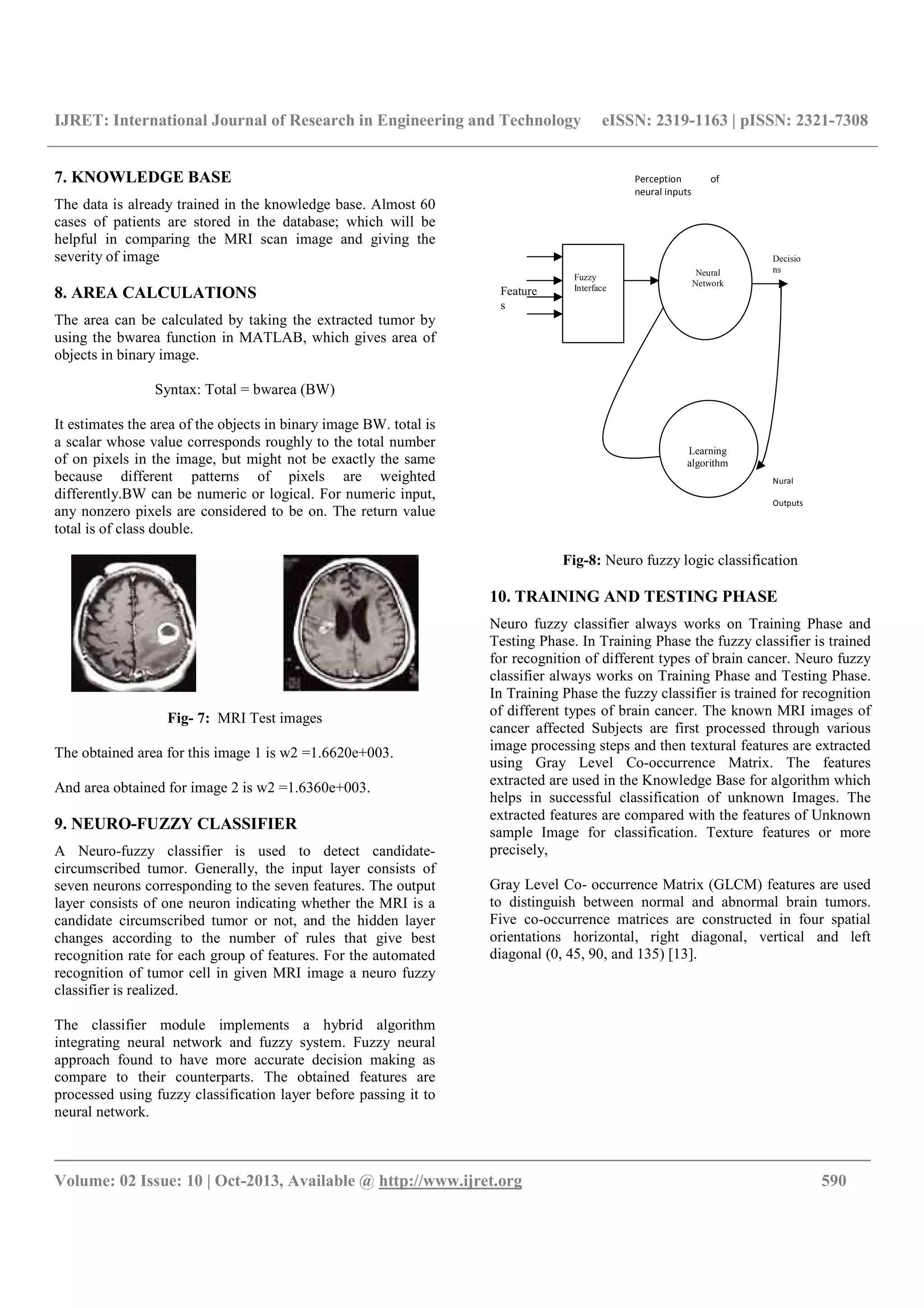 IJRET: International Journal of Research in Engineering and Technology eISSN: 2319-1163 | pISSN: 2321-7308
__________________________________________________________________________________________
Volume: 02 Issue: 10 | Oct-2013, Available @ http://www.ijret.org 590
7. KNOWLEDGE BASE
The data is already trained in the knowledge base. Almost 60
cases of patients are stored in the database; which will be
helpful in comparing the MRI scan image and giving the
severity of image
8. AREA CALCULATIONS
The area can be calculated by taking the extracted tumor by
using the bwarea function in MATLAB, which gives area of
objects in binary image.
Syntax: Total = bwarea (BW)
It estimates the area of the objects in binary image BW. total is
a scalar whose value corresponds roughly to the total number
of on pixels in the image, but might not be exactly the same
because different patterns of pixels are weighted
differently.BW can be numeric or logical. For numeric input,
any nonzero pixels are considered to be on. The return value
total is of class double.
Fig- 7: MRI Test images
The obtained area for this image 1 is w2 =1.6620e+003.
And area obtained for image 2 is w2 =1.6360e+003.
9. NEURO-FUZZY CLASSIFIER
A Neuro-fuzzy classifier is used to detect candidate-
circumscribed tumor. Generally, the input layer consists of
seven neurons corresponding to the seven features. The output
layer consists of one neuron indicating whether the MRI is a
candidate circumscribed tumor or not, and the hidden layer
changes according to the number of rules that give best
recognition rate for each group of features. For the automated
recognition of tumor cell in given MRI image a neuro fuzzy
classifier is realized.
The classifier module implements a hybrid algorithm
integrating neural network and fuzzy system. Fuzzy neural
approach found to have more accurate decision making as
compare to their counterparts. The obtained features are
processed using fuzzy classification layer before passing it to
neural network.
Fig-8: Neuro fuzzy logic classification
10. TRAINING AND TESTING PHASE
Neuro fuzzy classifier always works on Training Phase and
Testing Phase. In Training Phase the fuzzy classifier is trained
for recognition of different types of brain cancer. Neuro fuzzy
classifier always works on Training Phase and Testing Phase.
In Training Phase the fuzzy classifier is trained for recognition
of different types of brain cancer. The known MRI images of
cancer affected Subjects are first processed through various
image processing steps and then textural features are extracted
using Gray Level Co-occurrence Matrix. The features
extracted are used in the Knowledge Base for algorithm which
helps in successful classification of unknown Images. The
extracted features are compared with the features of Unknown
sample Image for classification. Texture features or more
precisely,
Gray Level Co- occurrence Matrix (GLCM) features are used
to distinguish between normal and abnormal brain tumors.
Five co-occurrence matrices are constructed in four spatial
orientations horizontal, right diagonal, vertical and left
diagonal (0, 45, 90, and 135) [13].
Feature
s
Fuzzy
Interface
Learning
algorithm
Neural
Network
Perception of
neural inputs
Decisio
ns
Nural
Outputs
 