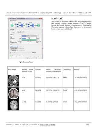 IJRET: International Journal of Research in Engineering and Technology eISSN: 2319-1163 | pISSN: 2321-7308
__________________________________________________________________________________________
Volume: 02 Issue: 10 | Oct-2013, Available @ http://www.ijret.org 591
Fig-9: Training Phase
11. RESULTS
The severity of the tumor is known and the different features
like entropy, Angular second moment (ASM), Contrast,
Inverse Difference Moment (Homogeneity), Dissimilarity.
The tumor region is extracted and the severity of the tumor is
found out and area is calculated.
MRI images Angular second
moment(ASM)
Contrast Inverse Difference
Moment (Homogeneity)
Dissimilarity Entropy
5526 1254072 0.138847811665570 20960 -75.2267956408215
6054 2045428 0.0170591123540511 26964 -150.867899634242
13492 1153082 36.7389217370720 19866 -382.254867873060
 
